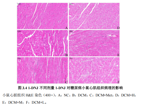 桑叶提取物防治糖尿病心肌病：1-DNJ被证实为核心功效成分