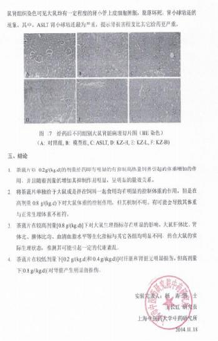 营养科招标-减重门诊-院线产品特性-权威院校实验数据-纯天然版奥利司他-全国独家茶蔬片火热招商中
