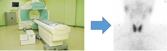 d-spect怎么检查【科普先锋】甲状腺也有“冷”和“热”？核医学的SPECT检查告诉你答案_https://www.jmylbn.com_新闻资讯_第2张