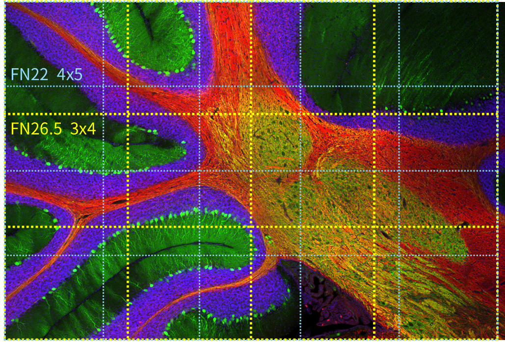 EVIDENT全新IXplore IX85 SpinXL和SpinSR轉(zhuǎn)盤共聚焦系統(tǒng)發(fā)布！