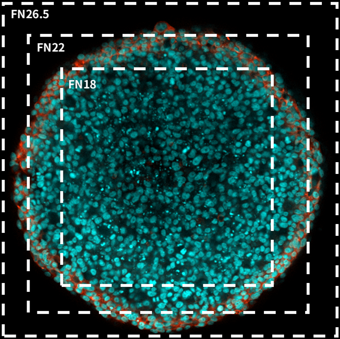 EVIDENT全新IXplore IX85 SpinXL和SpinSR轉(zhuǎn)盤共聚焦系統(tǒng)發(fā)布！