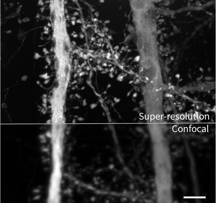 EVIDENT全新IXplore IX85 SpinXL和SpinSR轉(zhuǎn)盤共聚焦系統(tǒng)發(fā)布！