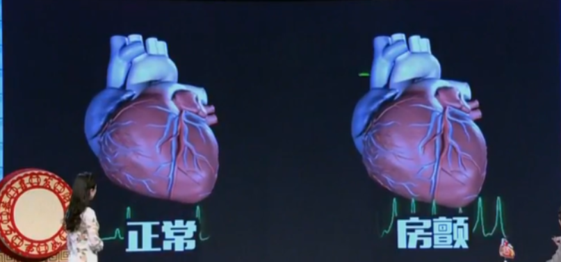 ce0118b6-6d9d-447a-aeed-64c061a05b9b.png