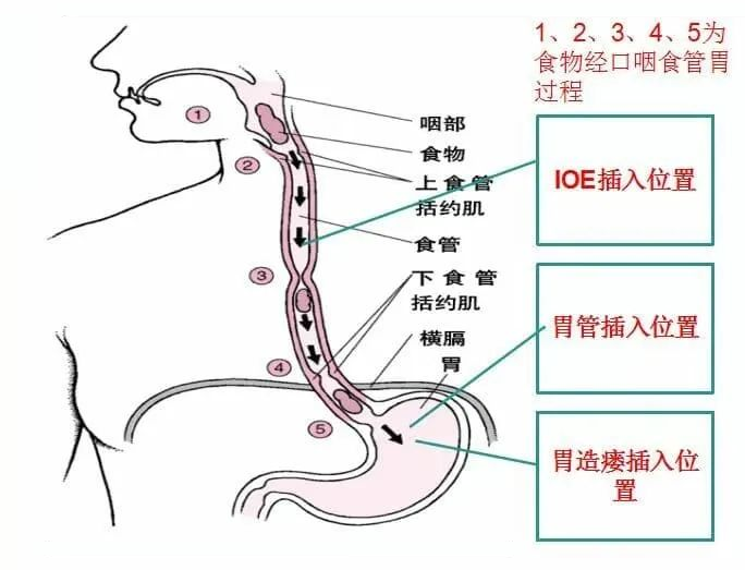 过程.png