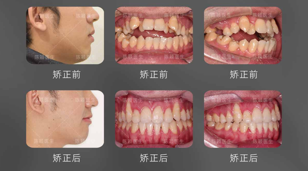 慈恩名人堂 | 陈颖：深耕美学正畸，用千例矫治雕琢自信笑颜