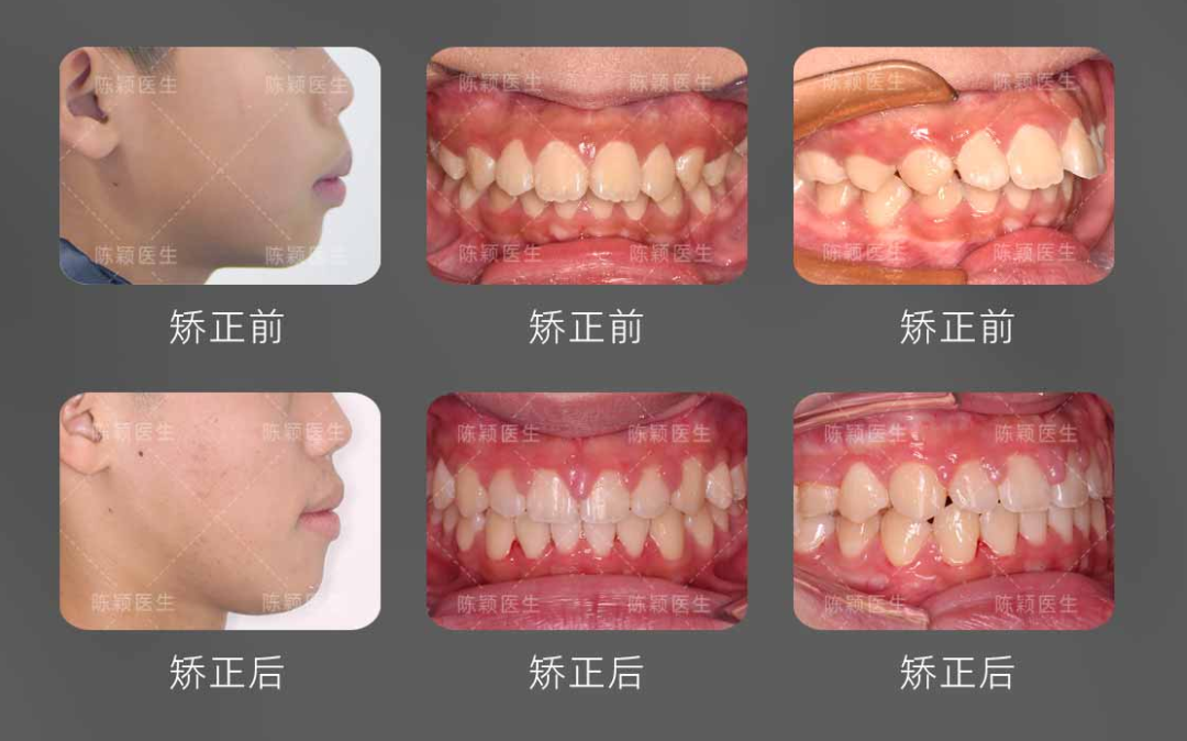 慈恩名人堂 | 陈颖：深耕美学正畸，用千例矫治雕琢自信笑颜